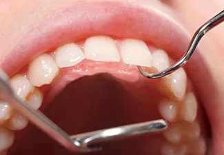 Dentist reviewing a patient dental examination