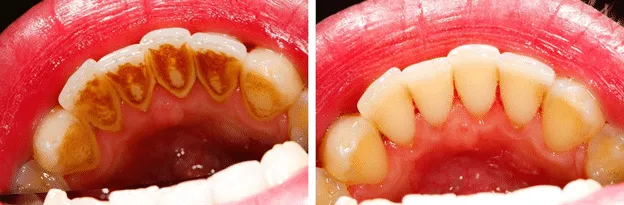 Mouth Maintenance VS Car Maintenance; Which Is More Important To You?