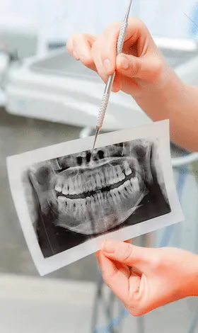 Dental X-ray