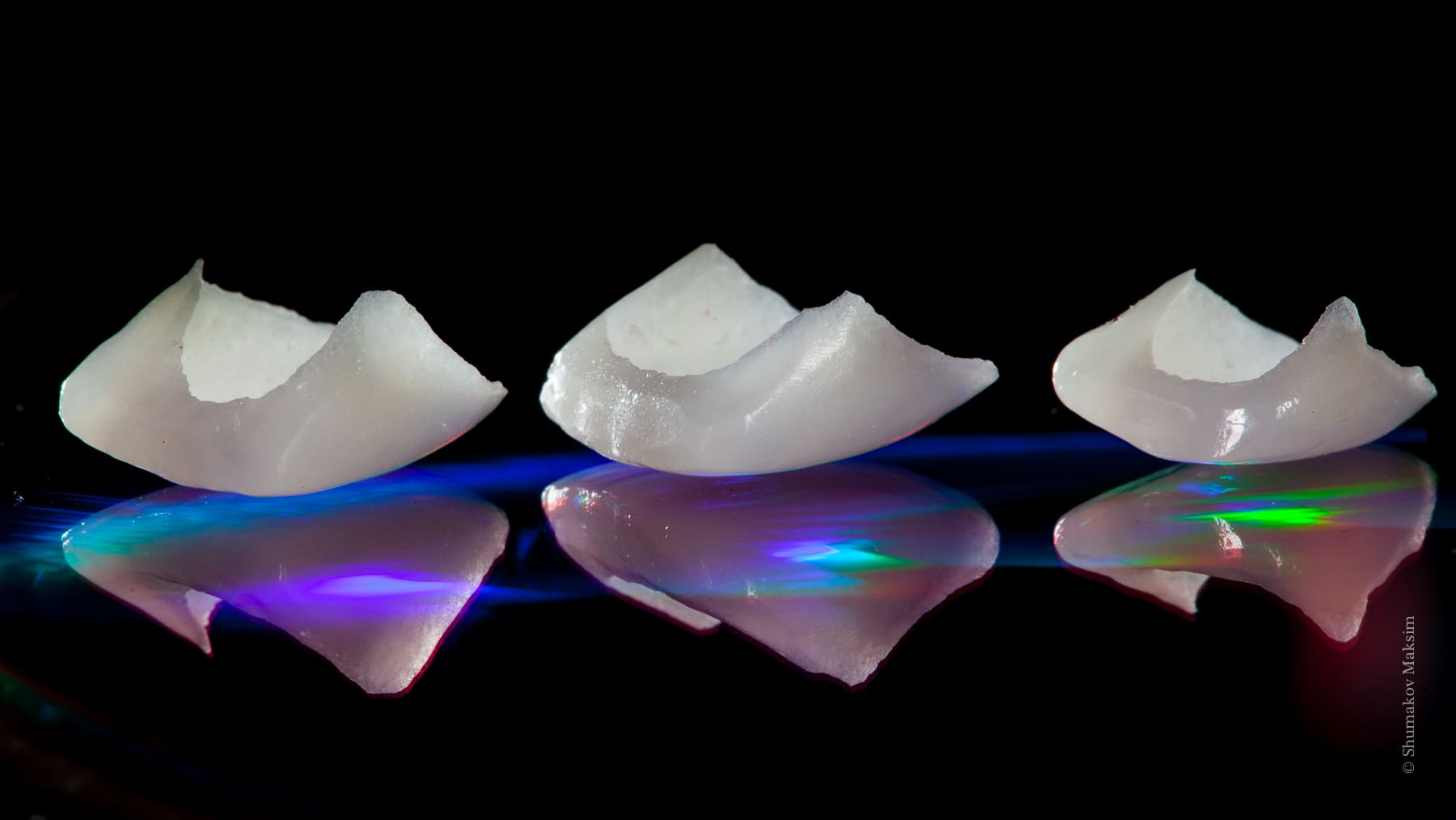 Custom porcelain veneer restorations fabricated to improve the color, shape, and appearance of front teeth at MyDental in Lutz, FL.