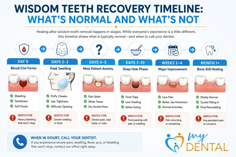 Wisdom teeth recovery timeline showing healing stages from surgery day through one month after extraction